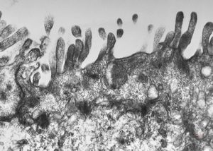 celiakia celiakia